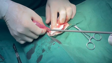 Animal ultrasonic cutter knife: an innovative tool for breaking through  traditional surgery - Xuzhou, Jiangsu, China - Jiangsu Dawei Medical
