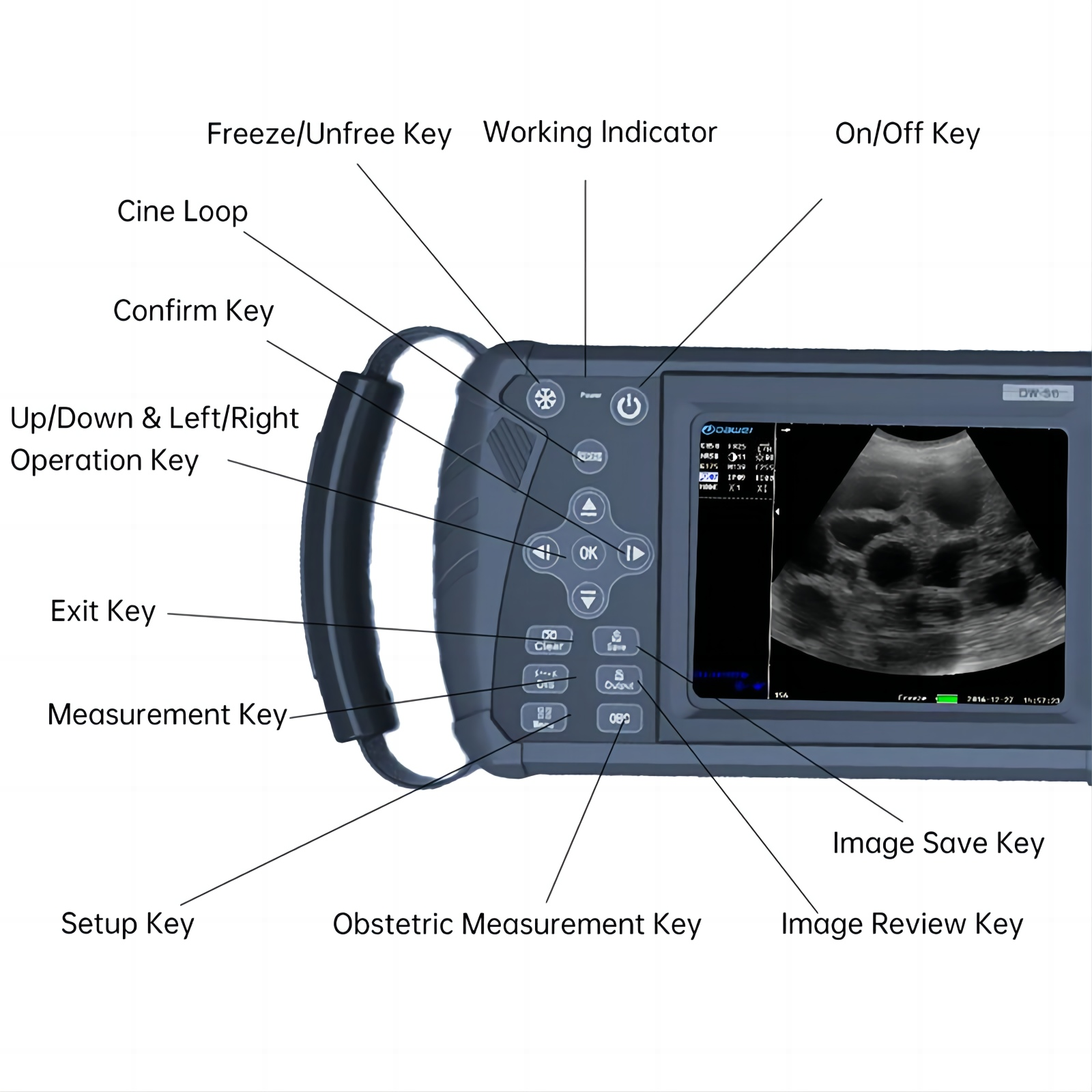 handheld veterinary ultrasound
