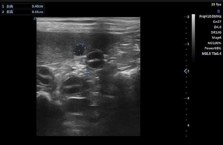 liver-imaging