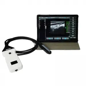 NEO Wireless Rectal Ultrasound Probe