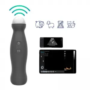 Ultras Wireless Ultrasound Probe 