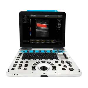 P3 Compact Veterinary Color Doppler for Clinics & Mobile Use