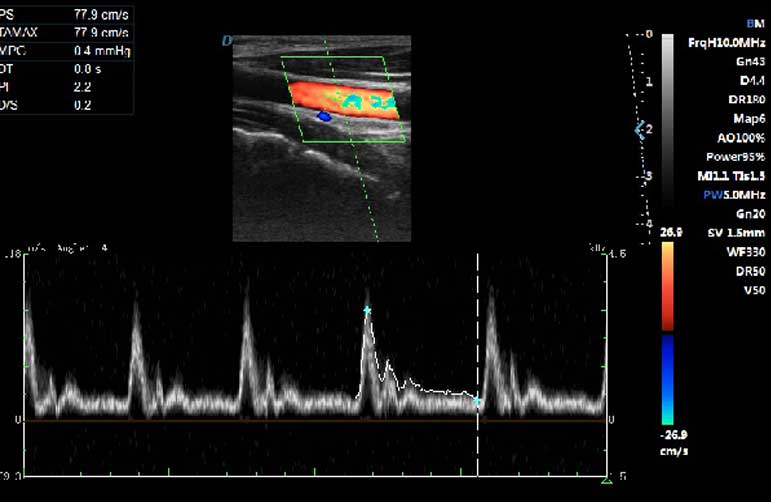 fonction-d'enveloppe-spectrale-(physique)