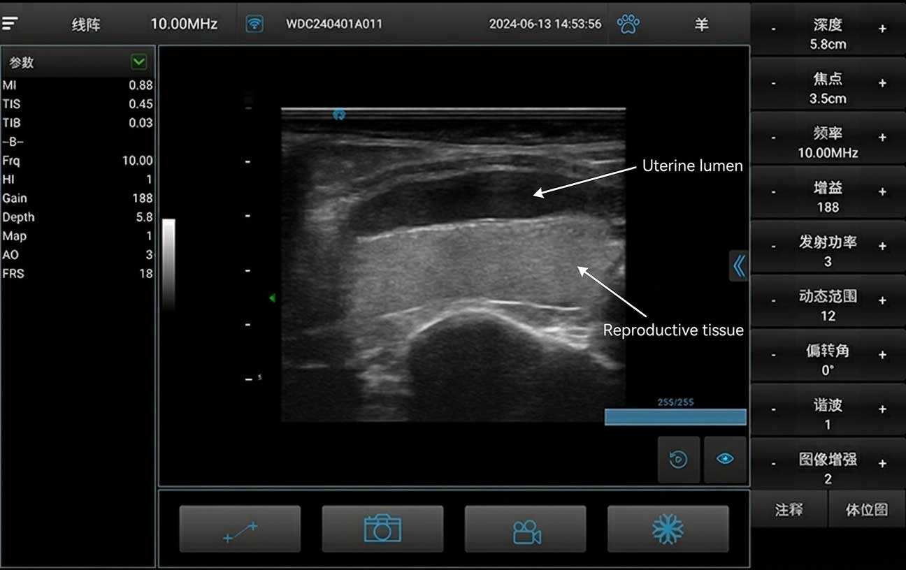 ultrasound_u7_annotated_en-(1)