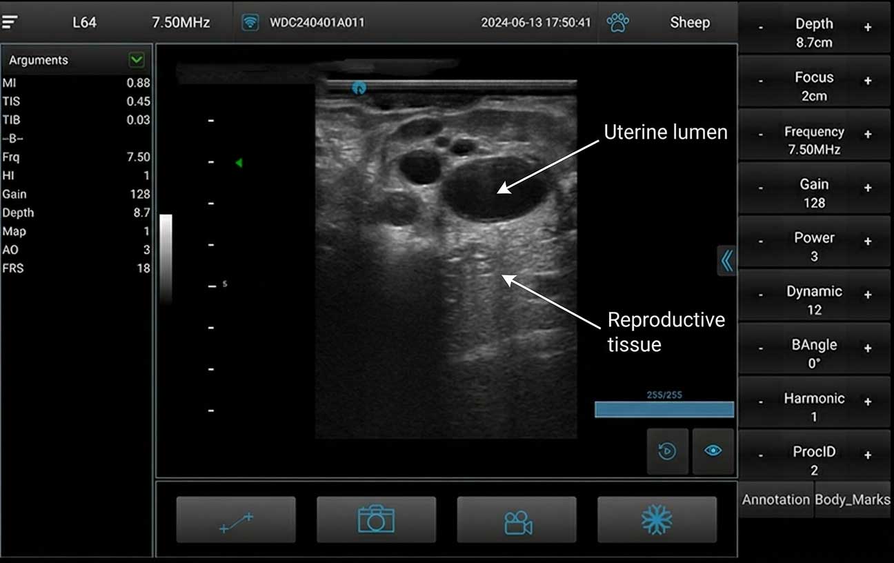 ultrasound_u9_annotated_en